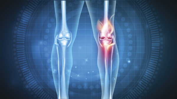 You are currently viewing If you have knee pain, telehealth may help